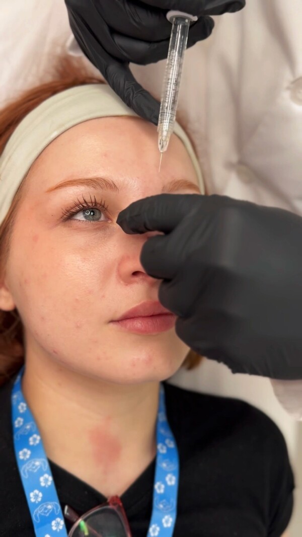 ✨ Rinomodelación en solo 30 minutos ✨Resultados naturales con ácido hialurónico de alta calidad, sin cirugía, sin complicaciones y con una recuperación instantánea. 💫 Transforma tu perfil y potencia tu belleza con un toque sutil y armonioso, todo en menos tiempo del que imaginas.

¿Te gustaría mejorar tu perfil? ¡Contáctanos y descubre cómo podemos ayudarte a lograrlo!

📍En PURÄ Medicina Estética, cuidamos cada detalle para que te sientas en las mejores manos.

puramedicinaestetica purämedicinaestética medicinaesteticamalaga rinomodelacionmálaga rinomodelacionmalaga rinomodelaciónmalaga rinomodelaciónmálaga clinicaesteticamalga